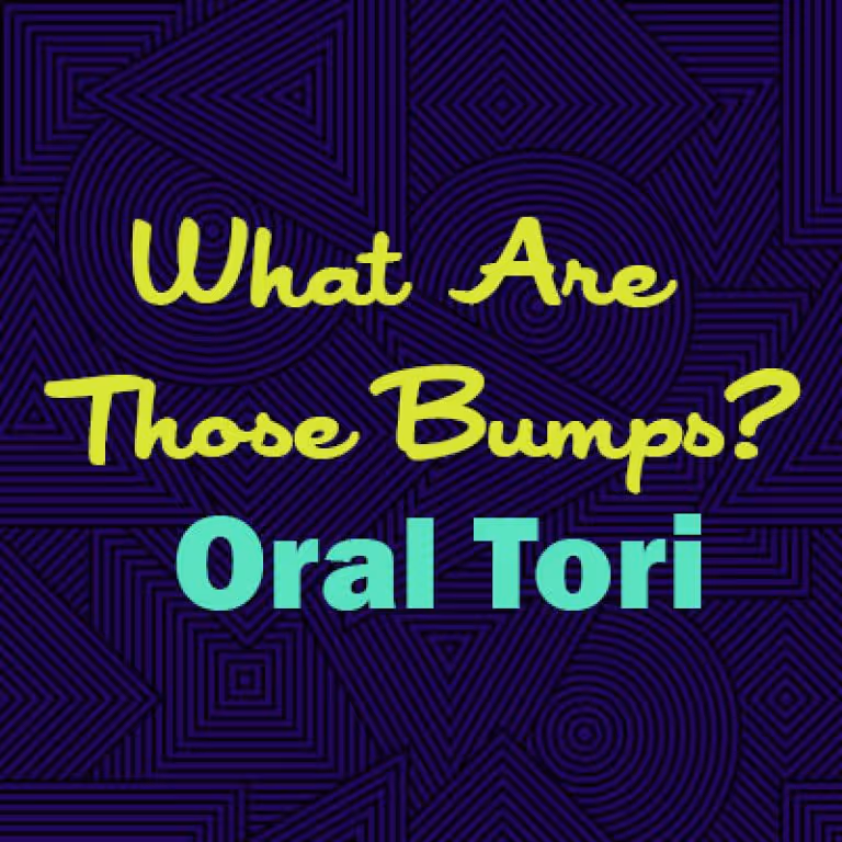 What are Those Bumps? Oral Tori
