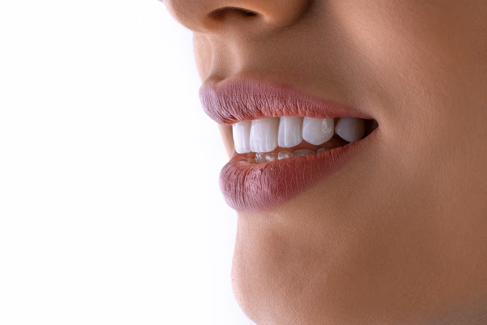 Understanding The All-On-4 Dental Implants For A Full Smile Makeover