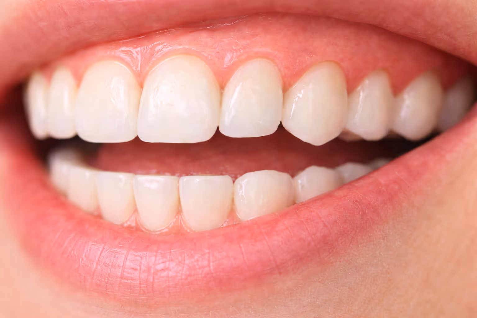 Pocket Reduction Surgery at Lakevie Dental