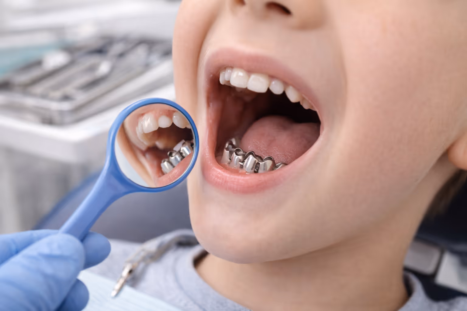Temporary & Pediatric Protective Crowns at Lakevie Dental