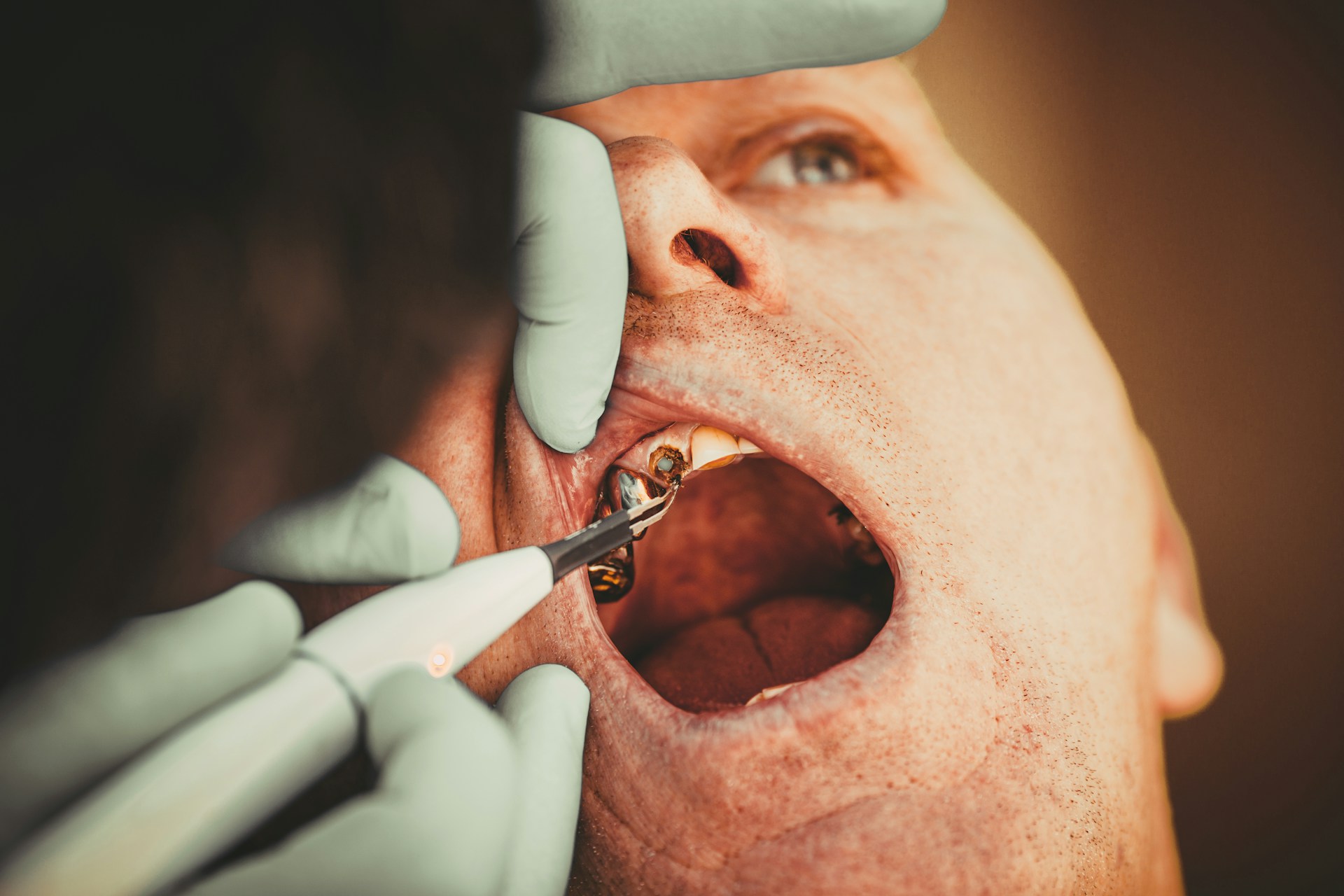 How Periodontal Therapy Treatment Helps Reverse Gum Decline