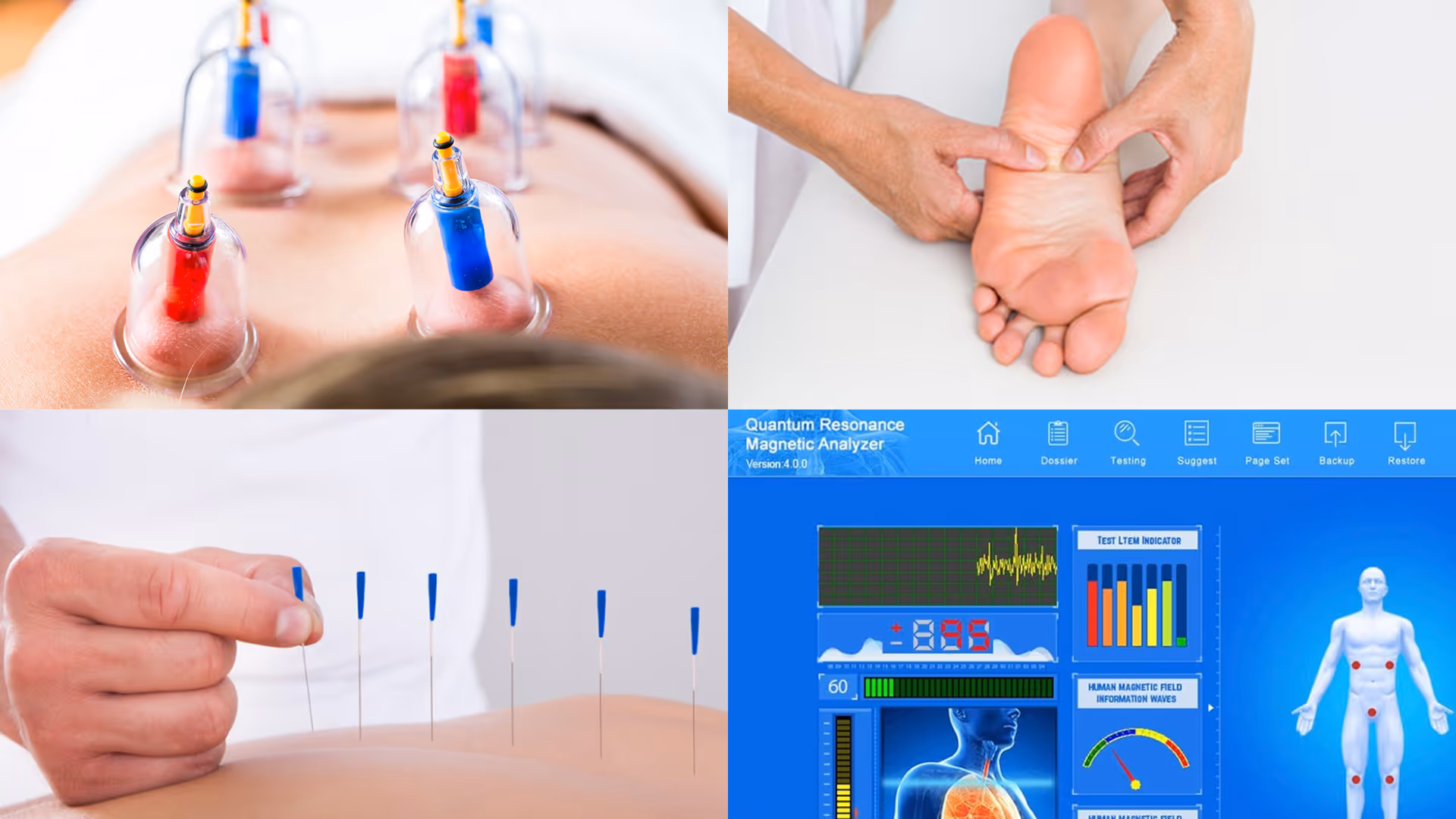 Vierteilige Collage mit Schröpfgläsern auf dem Rücken, Fußmassage, Akupunkturnadeln in der Haut und einem Bildschirm mit Quantumschwingungs-Analyse.