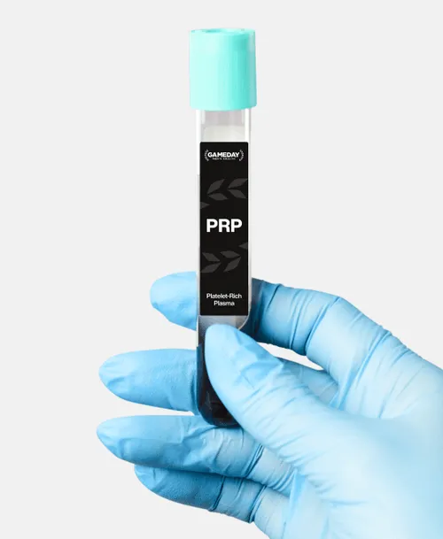 Gameday Men’s Health branded PRP treatment vials prepared for hair restoration therapy on a sterile white surface.