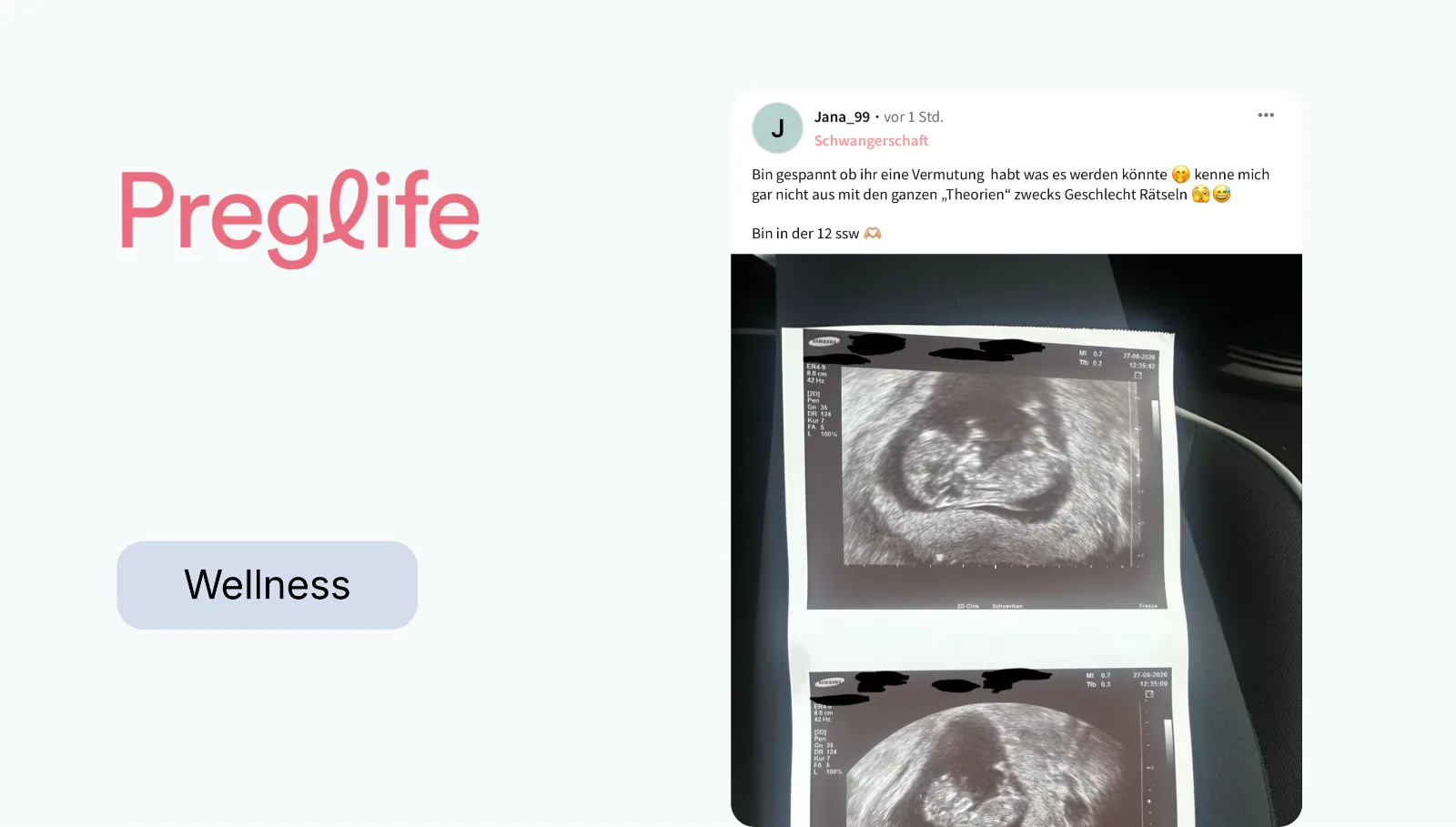 One community, four markets: how Preglife scaled with Octopus Community