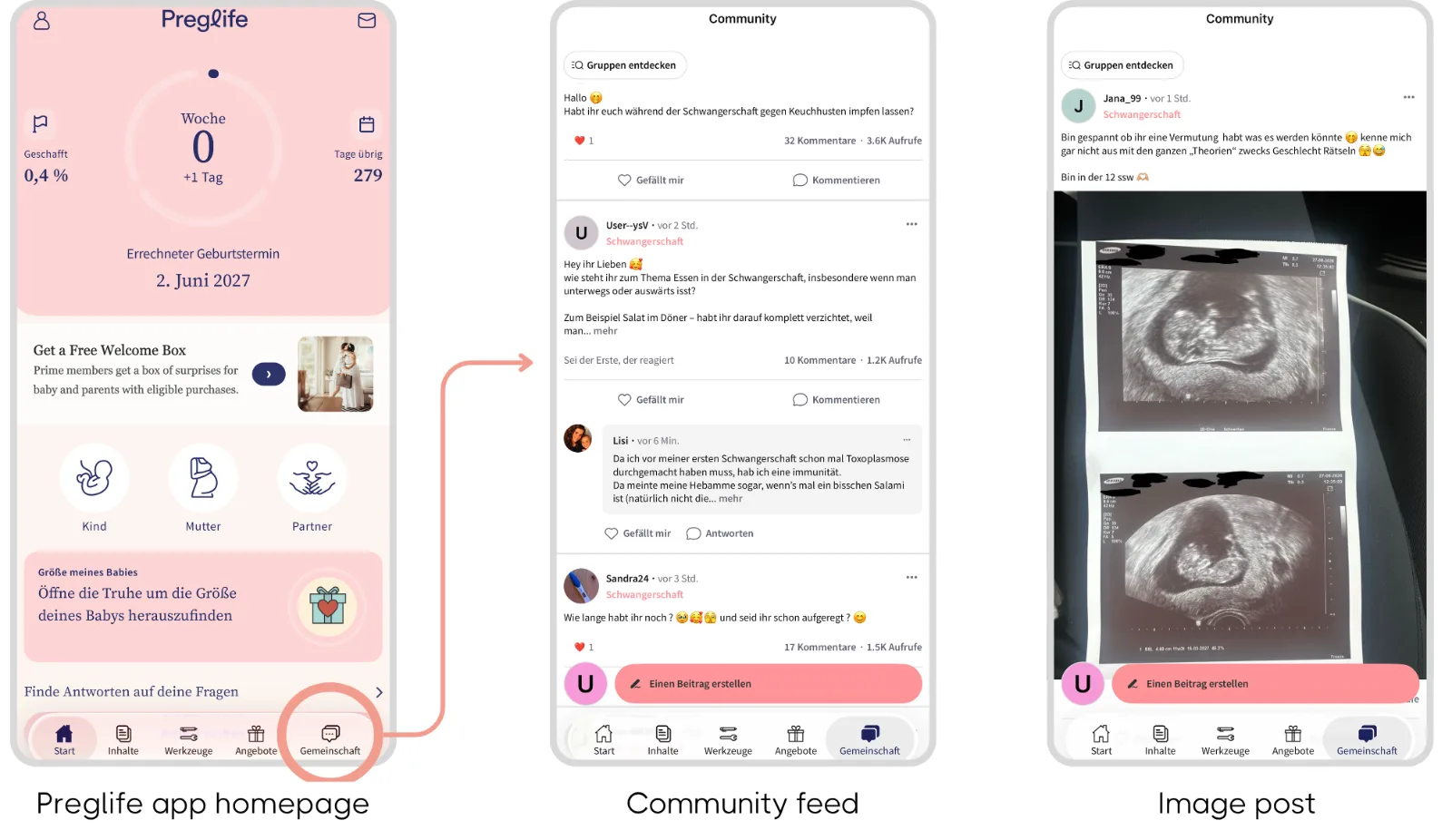 Preglife in-app community case study — key visual