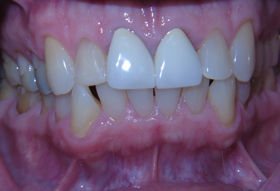 Before Image