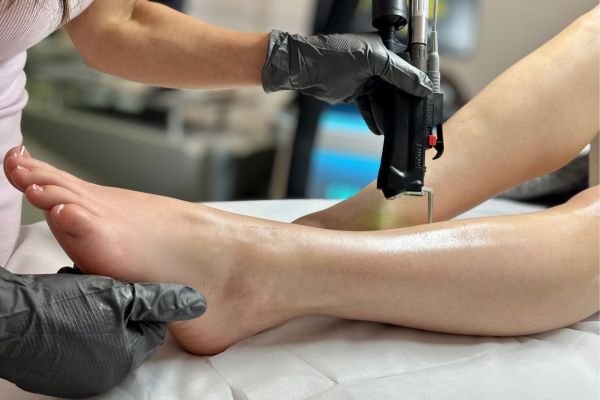 Close-up of a person receiving a laser treatment on their leg by a professional wearing black gloves.