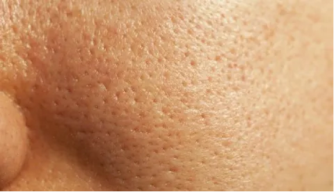 A close up of a person's nose and nose.