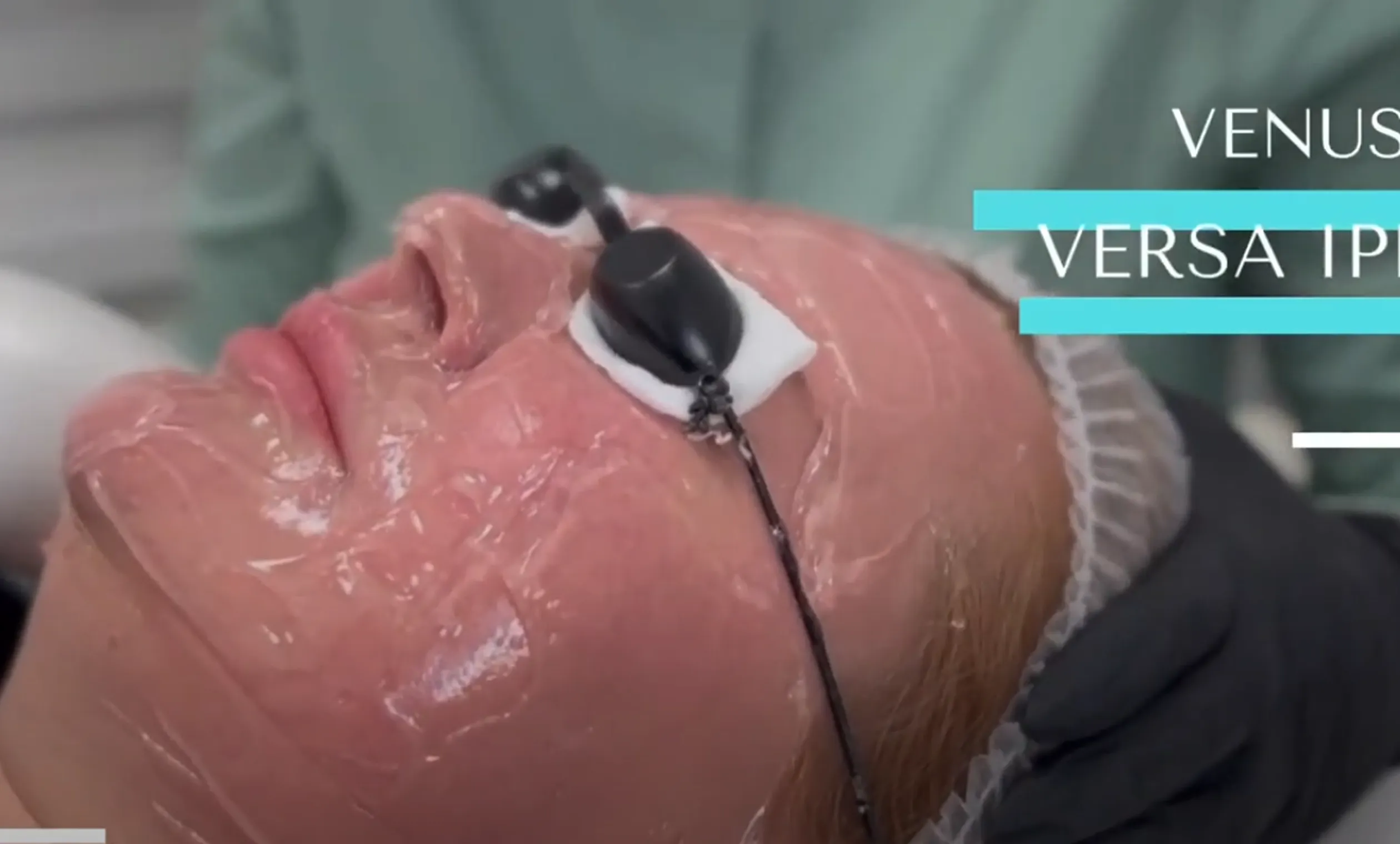 A woman getting a facial peel from a machine.