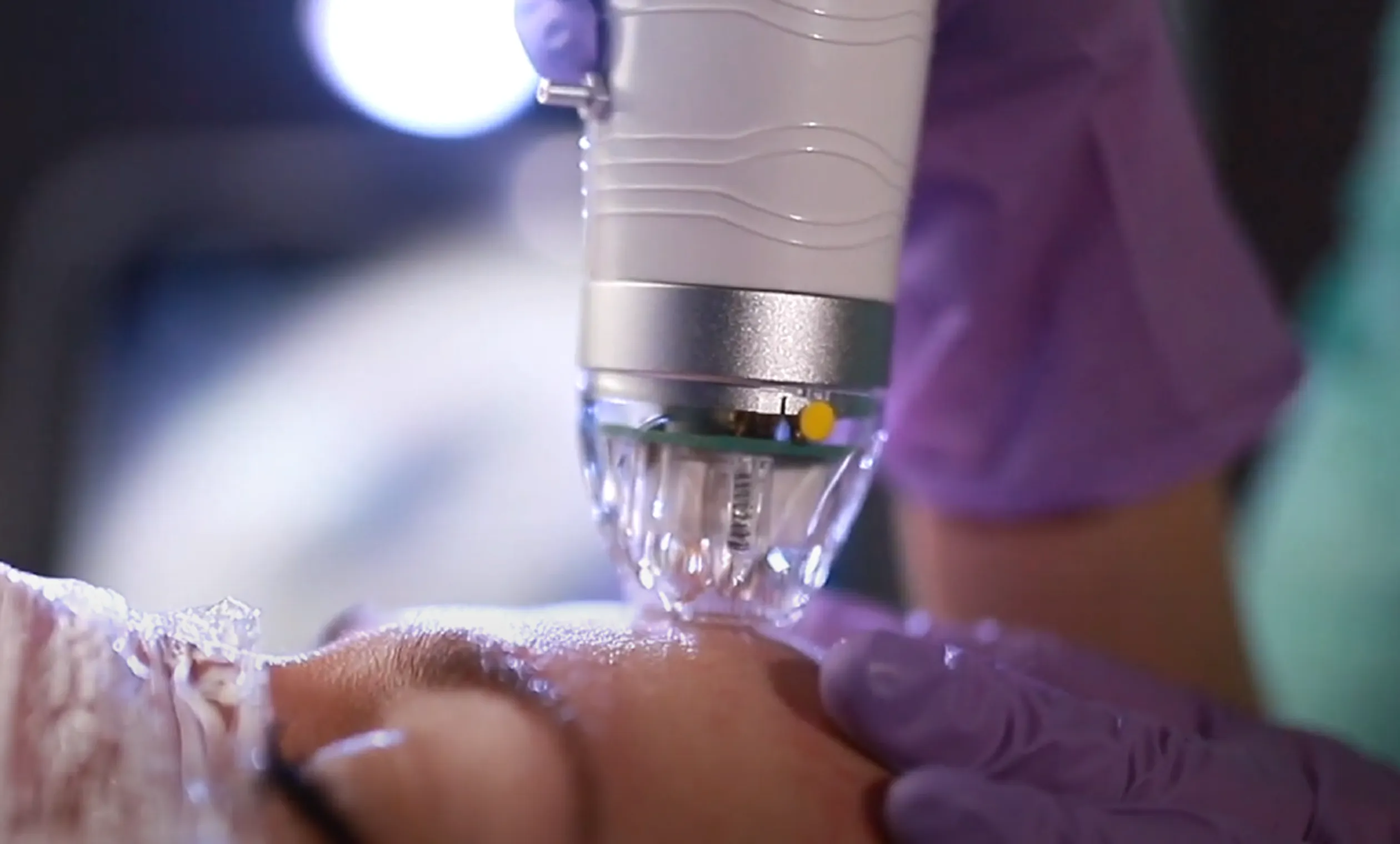 A close up of a person getting an oxygen.