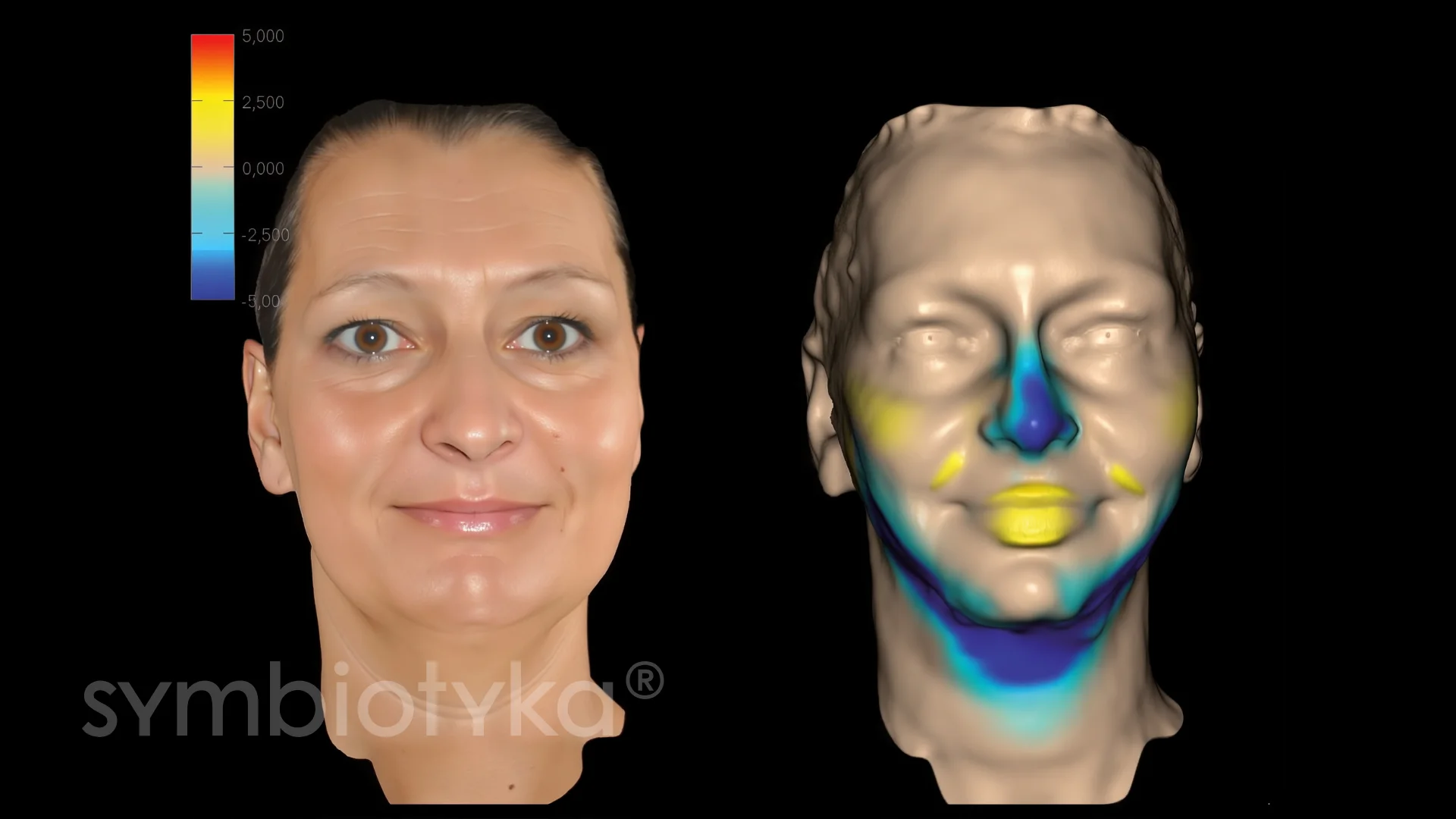 Side-by-side images showing a woman's facial photograph and a 3D face model with color-coded regions indicating varying surface measurements.