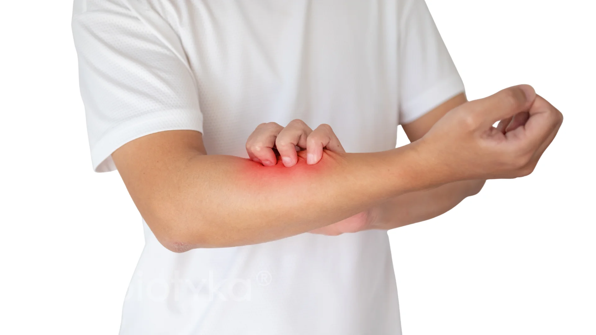 Person scratching their forearm showing red irritated skin indicating itch or rash.