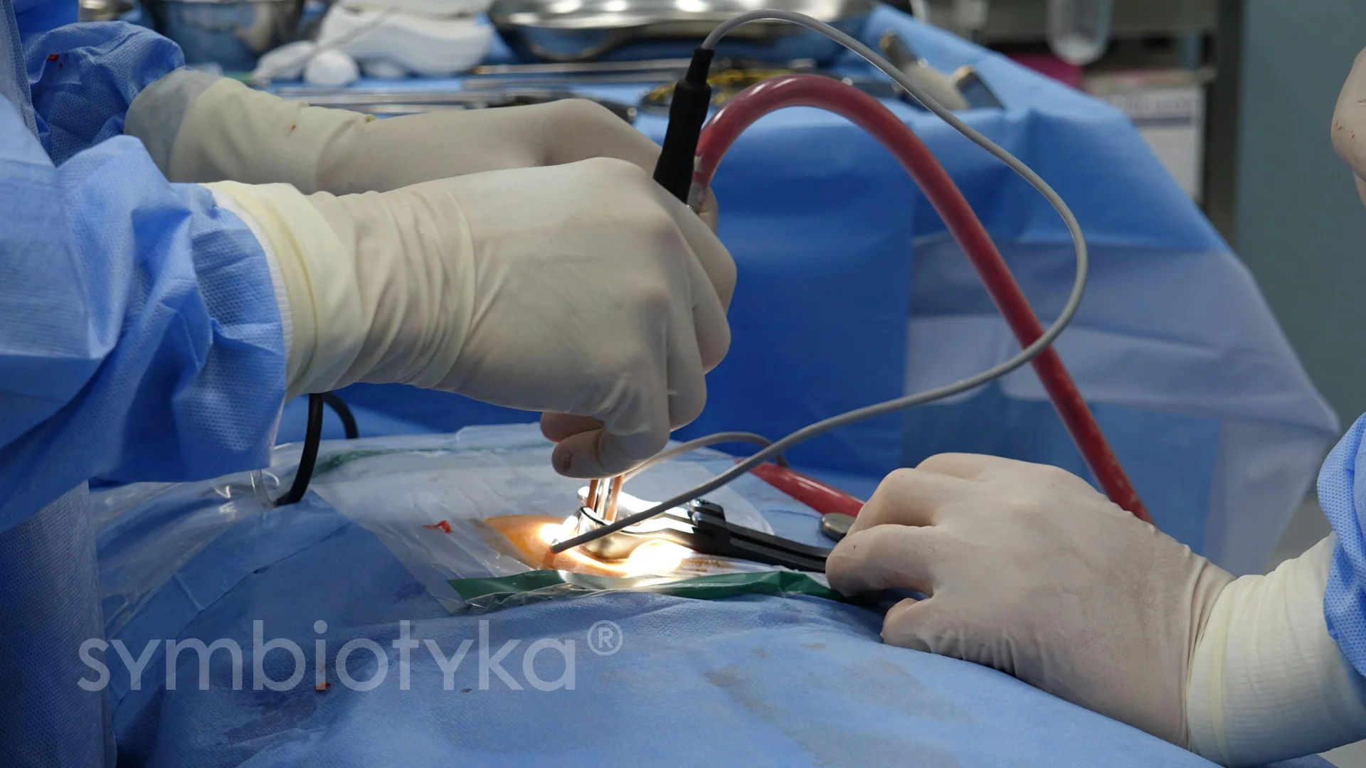 Хірург у рукавичках виконує операцію з використанням медичного інструменту у стерильному середовищі.