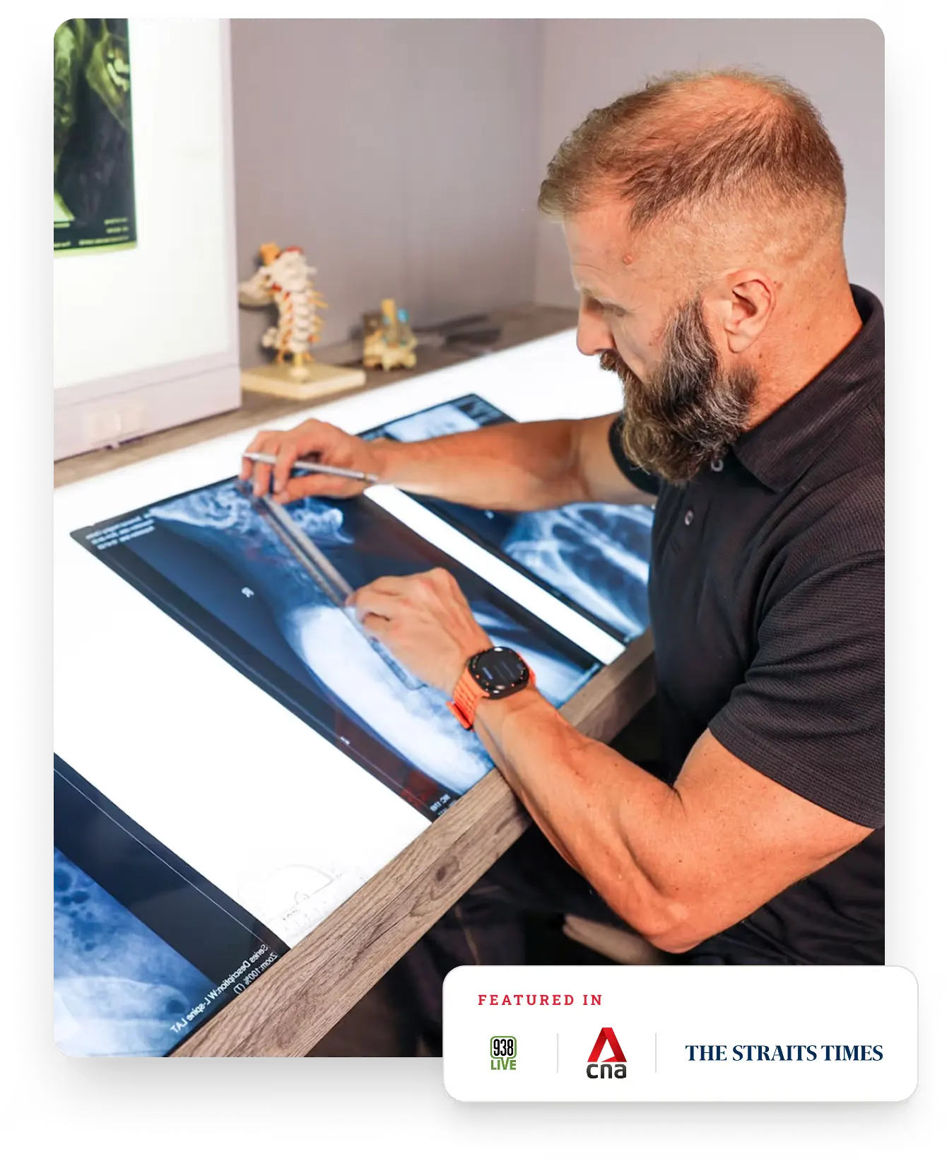 Dr. Will Kalla, a structural neck pain specialist in Singapore, measuring alignment vectors on digital cervical X-rays at a clinic view box.