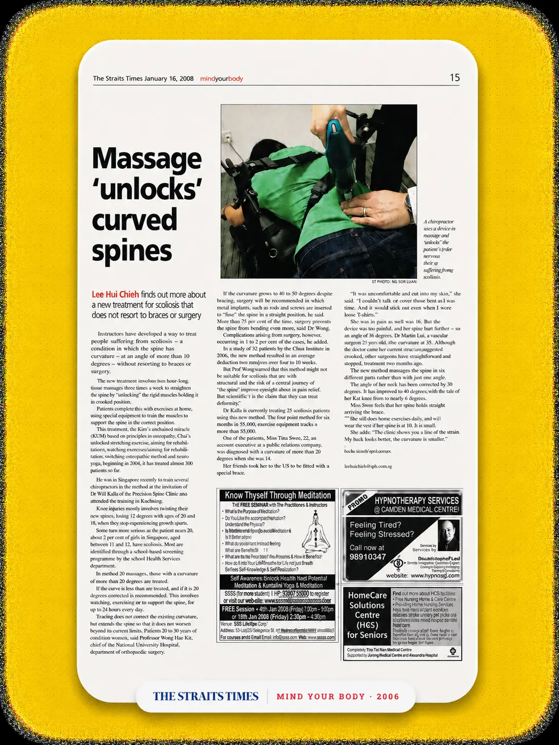 An archived news print snippet from The Straits Times detailing how Dr. Will Kalla pioneered structural spine re-modeling techniques in Singapore.