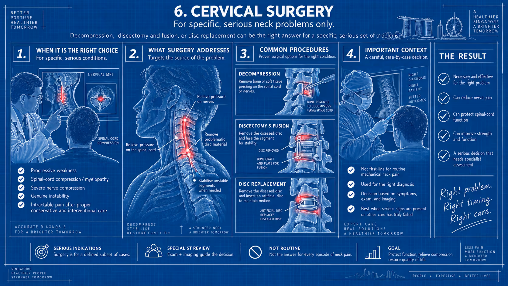 Cervical surgery for neck pain in Singapore: a last resort for structural or neurological problems