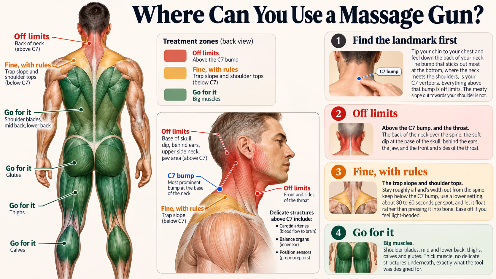 Massage gun safe and unsafe zones: the neck above the C7 bump is off limits, the trap slope and large muscles are not
