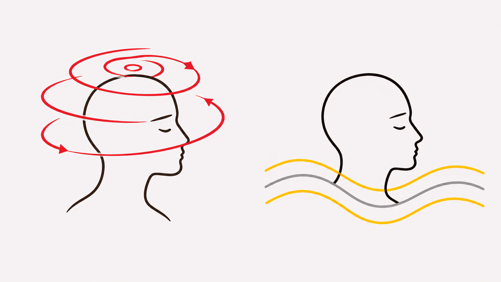 Spinning vertigo compared with a floating, rocking unsteadiness