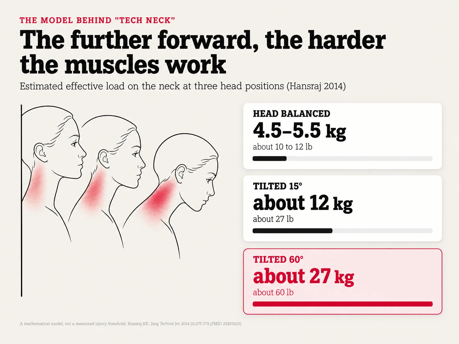 Side profiles of a head upright and tilted forward, with estimated neck load of about 5, 12 and 27 kg