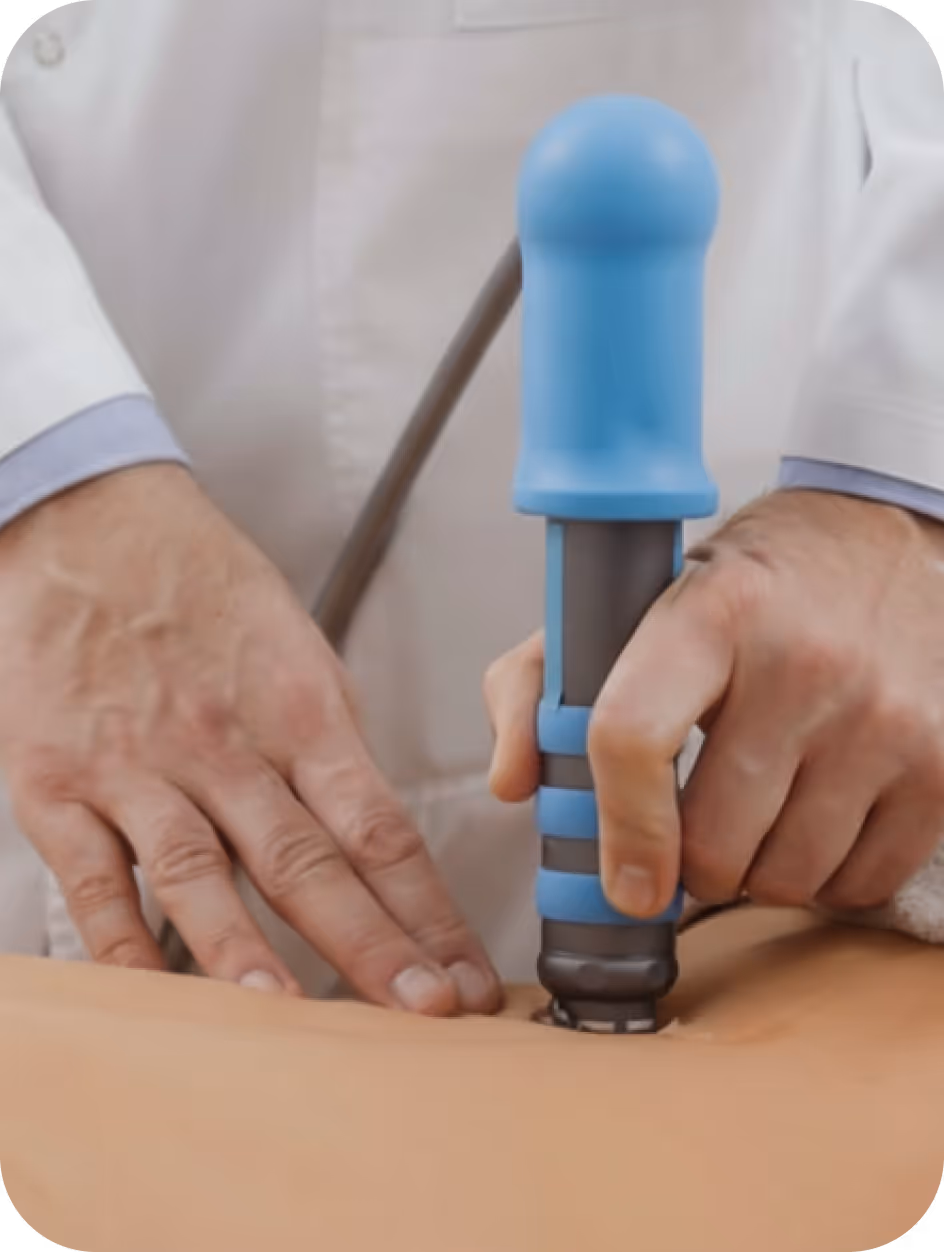 Anwendung der Stoßwellentherapie mit einem modernen Therapiegerät zur Behandlung chronischer Schmerzen in der Chiropraxis Gärtner in Braunschweig.