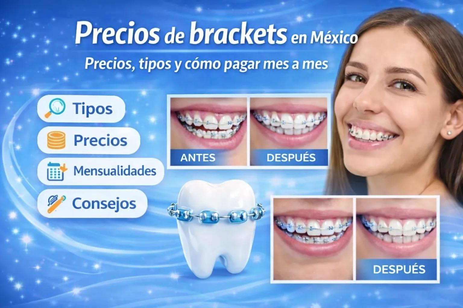 Precios de brackets en México: costos, tipos y pagos mensuales
