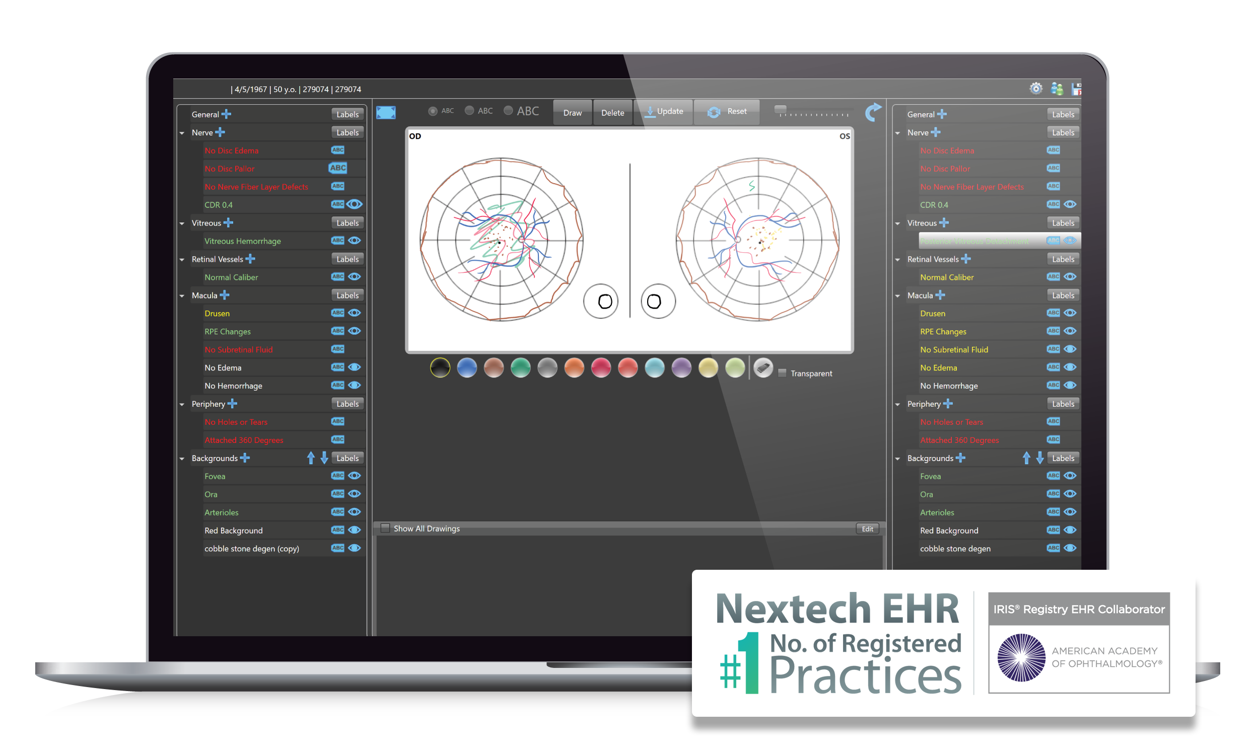 Nextech_product