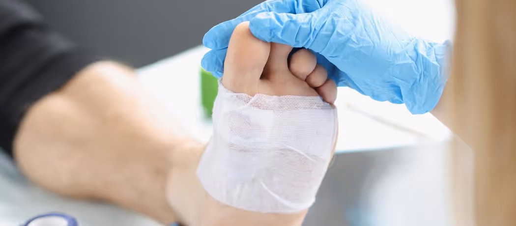 Healthcare professional wearing blue gloves applying a bandage to a patient's foot.