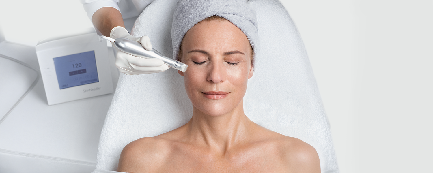Microneedlingbehandeling met Reviderm