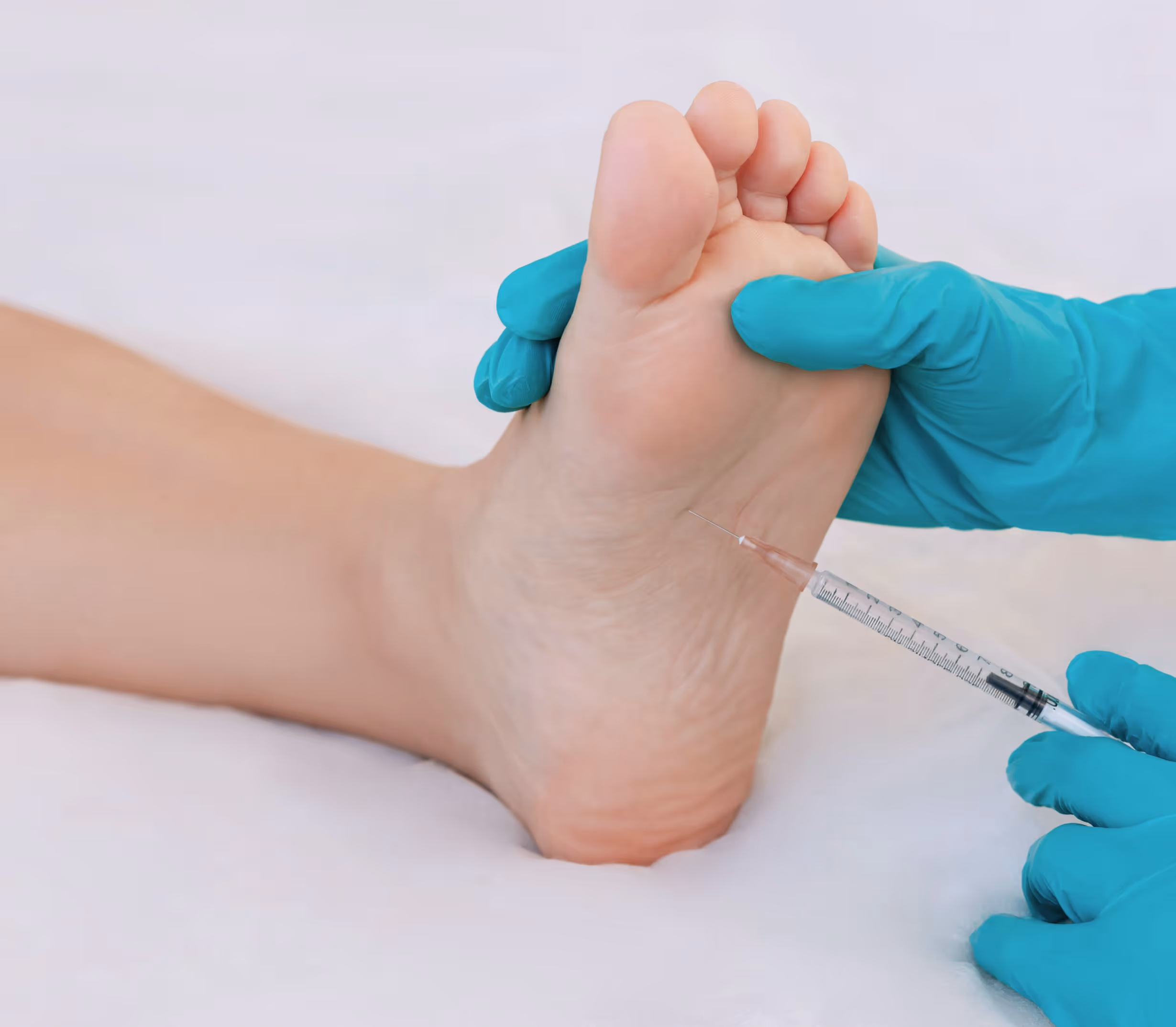 Doctor treats tendon injury in Los Angeles with PRP therapy to accelerate recovery and provide minimally invasive treatment.