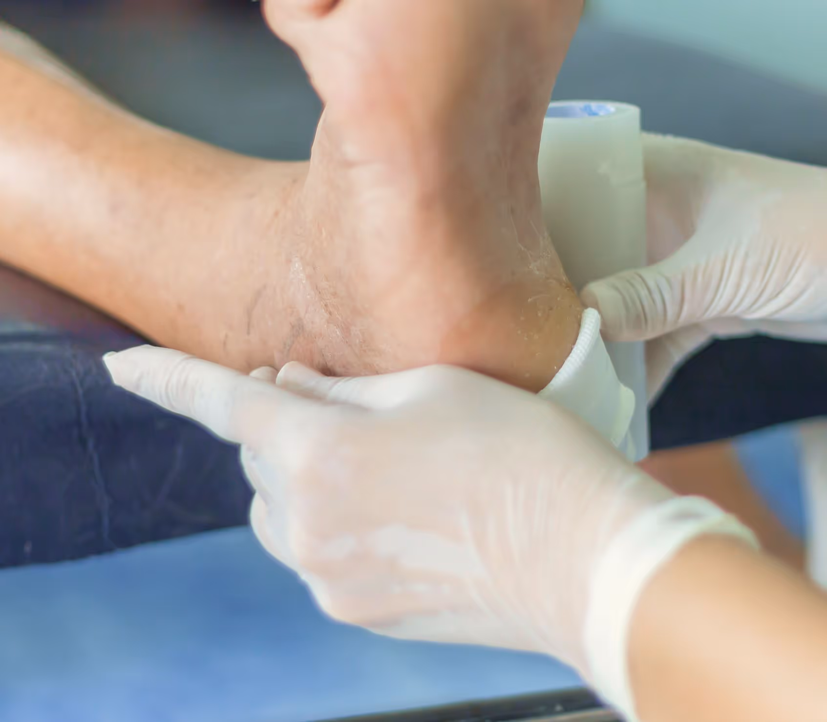 Doctor examines diabetic foot in Los Angeles, focusing on vascular support, dressings, and debridement for wound care.