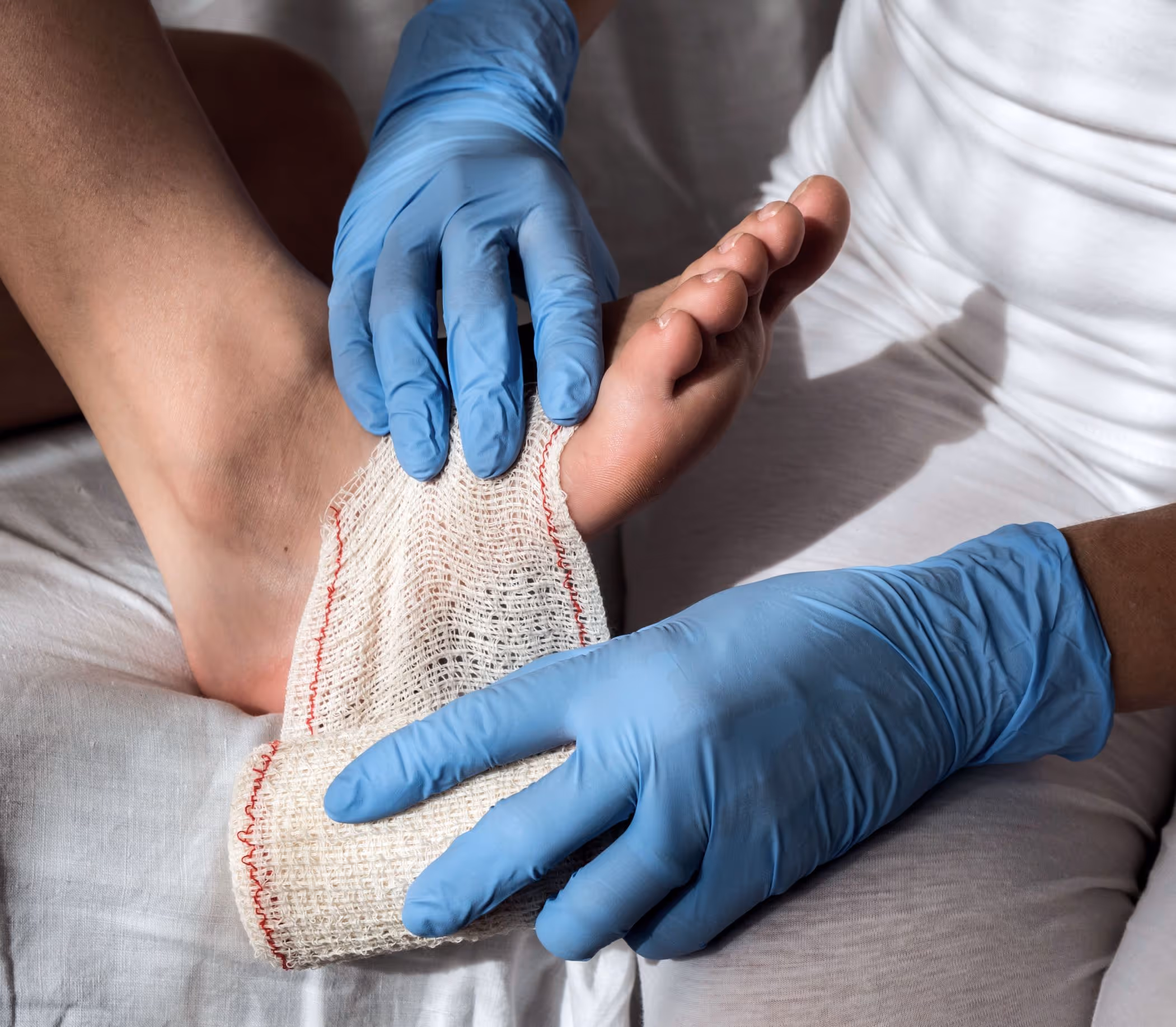 Person in white shirt and blue gloves treats ankle sprain with swelling and pain during urgent care visit in Los Angeles.