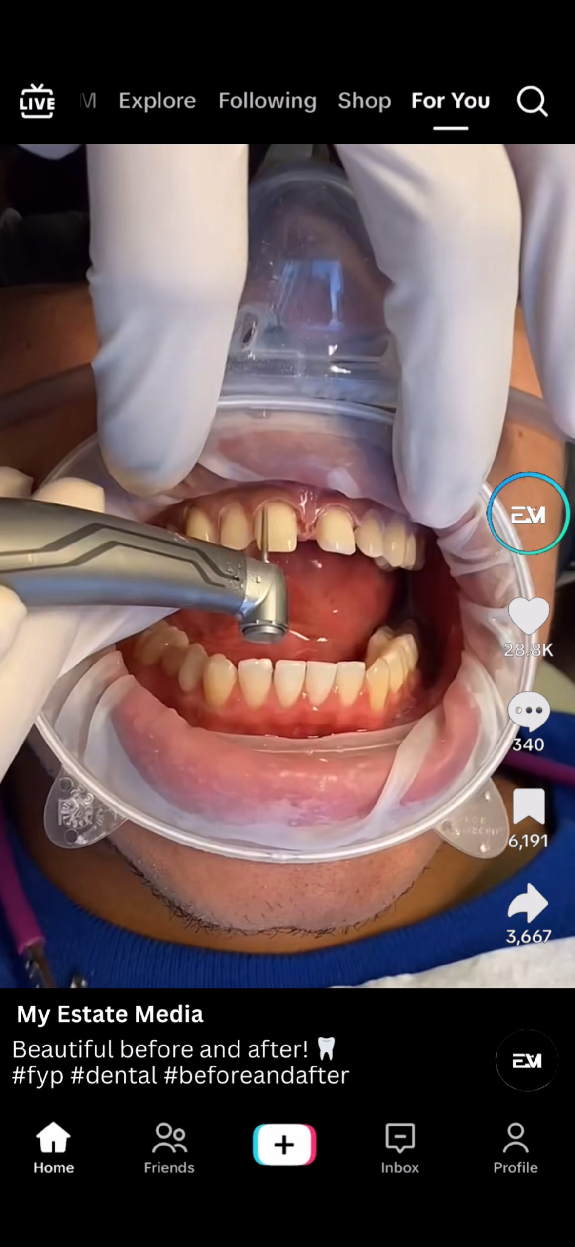 Real Estate Marketing Front Vs Back Engaging TikTok