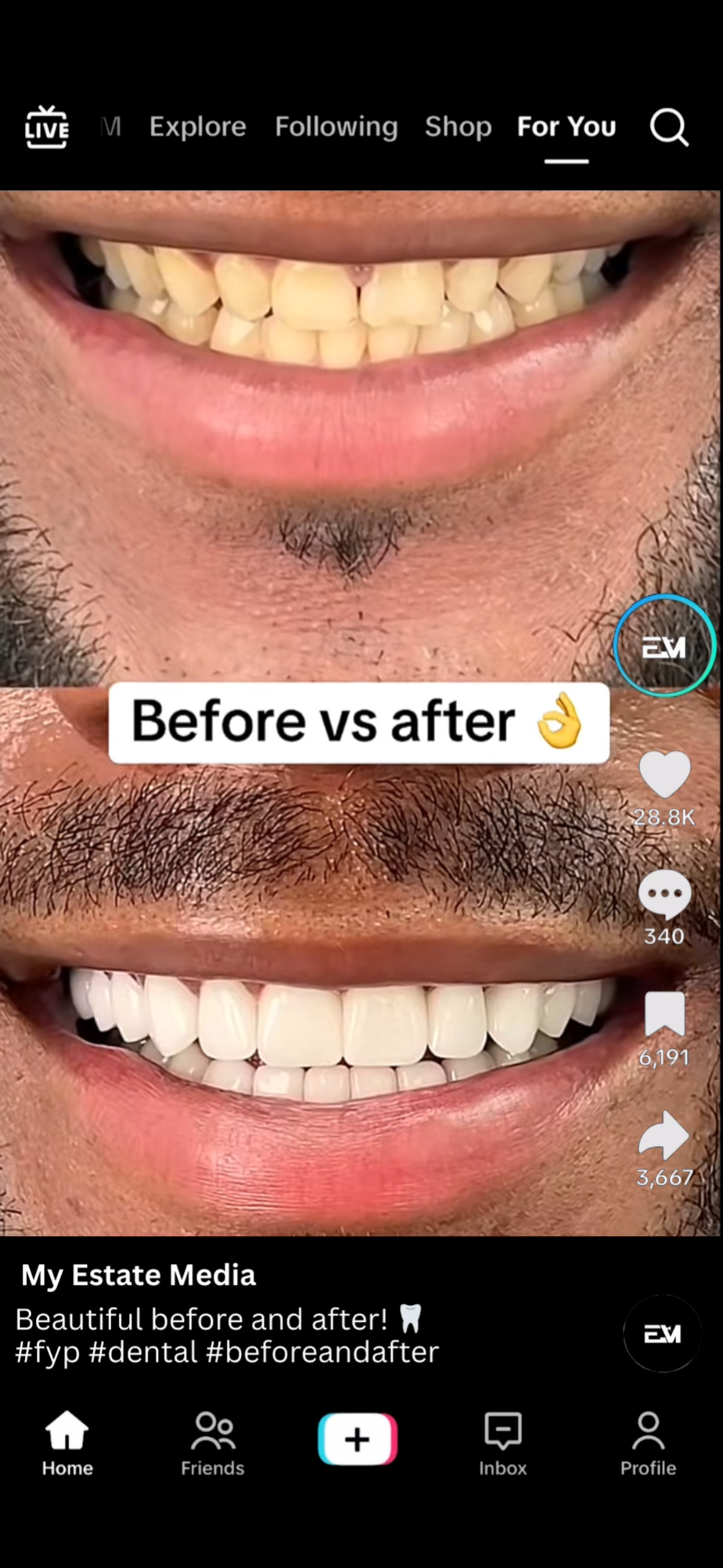 Real Estate Marketing Total Cost Breakdown