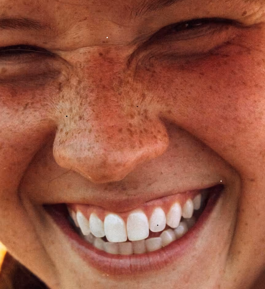 Close-up of a smiling face with freckles, showing white teeth and closed eyes.