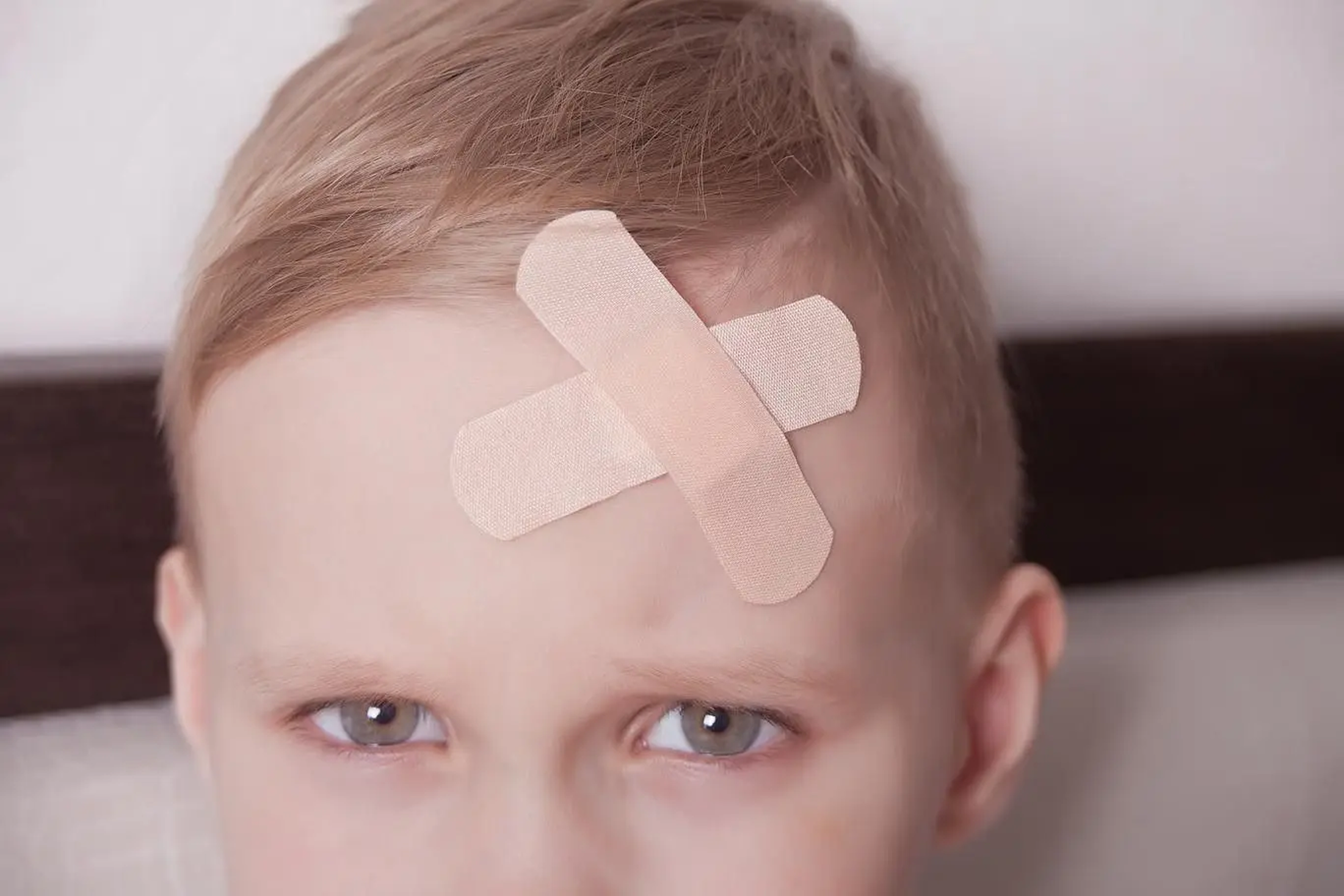 A young child with two adhesive bandages in a cross shape on their forehead looks ahead with a calm expression.