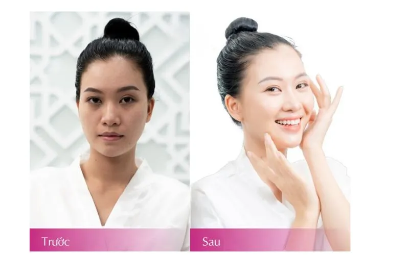 Tắm trắng da mặt giúp làn da mịn màng, rạng rỡ và khỏe mạnh tự nhiên.