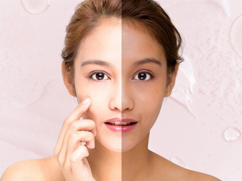 Dưỡng ẩm giúp da nhanh chóng phục hồi trắng sáng hơn