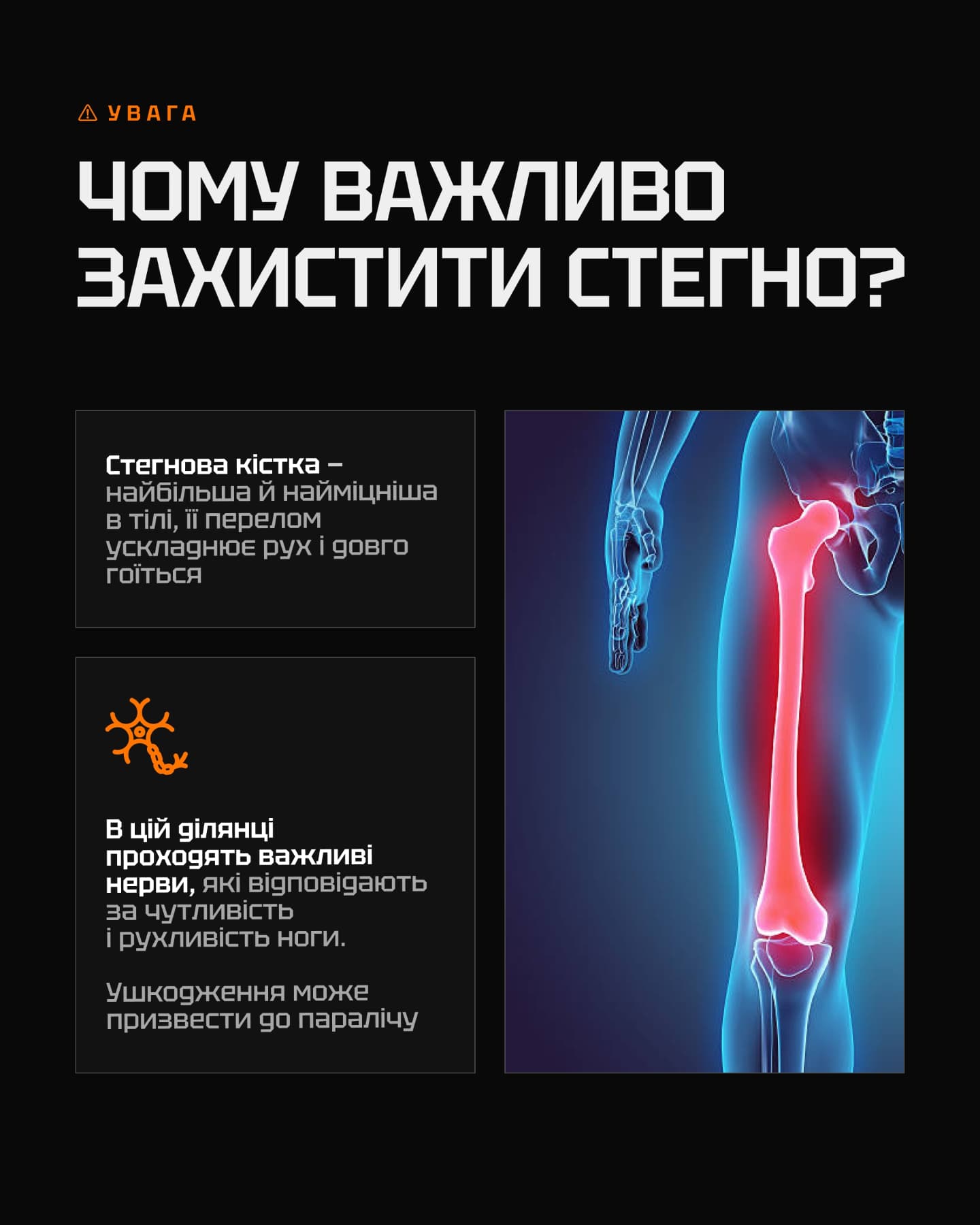 Анатомічна ілюстрація стегнової кістки та зони основних ризиків