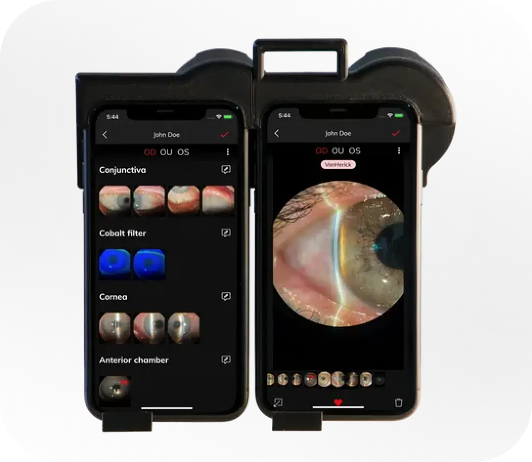 Appareil ophtalmologique Eclipse, vue de face