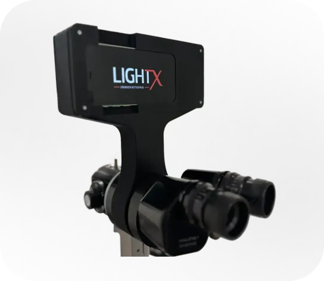 Appareil ophtalmologique EyeCaster