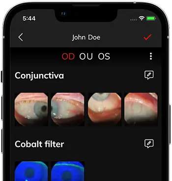 Vue de l'application de santé oculaire LightX sur un appareil mobile