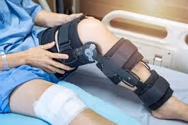 gait analysis