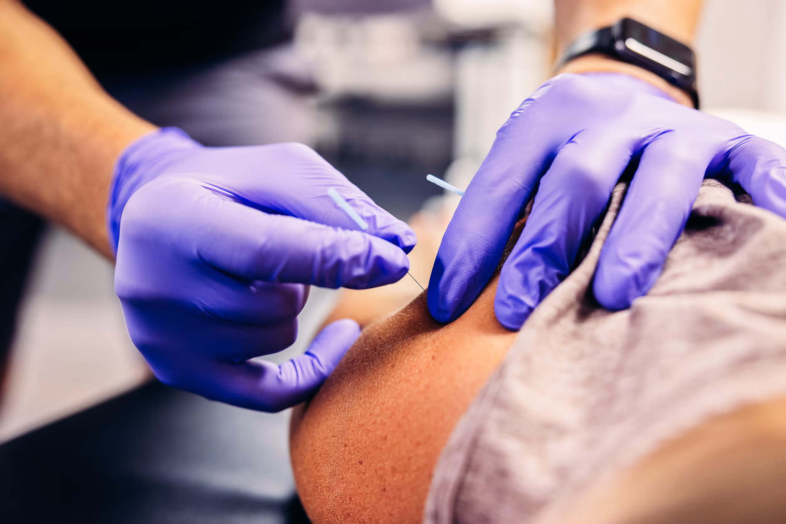 Dry needling wilmington