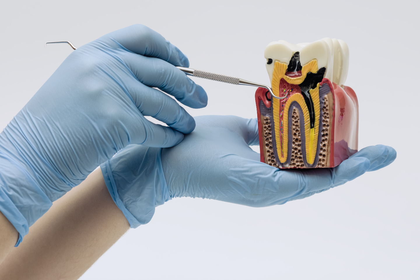 Endodontics in Somerton