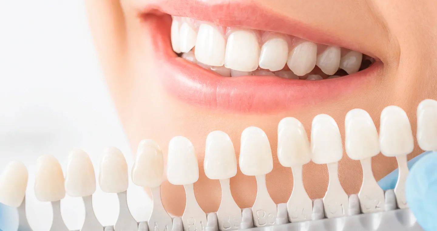 Teeth whitening service icon