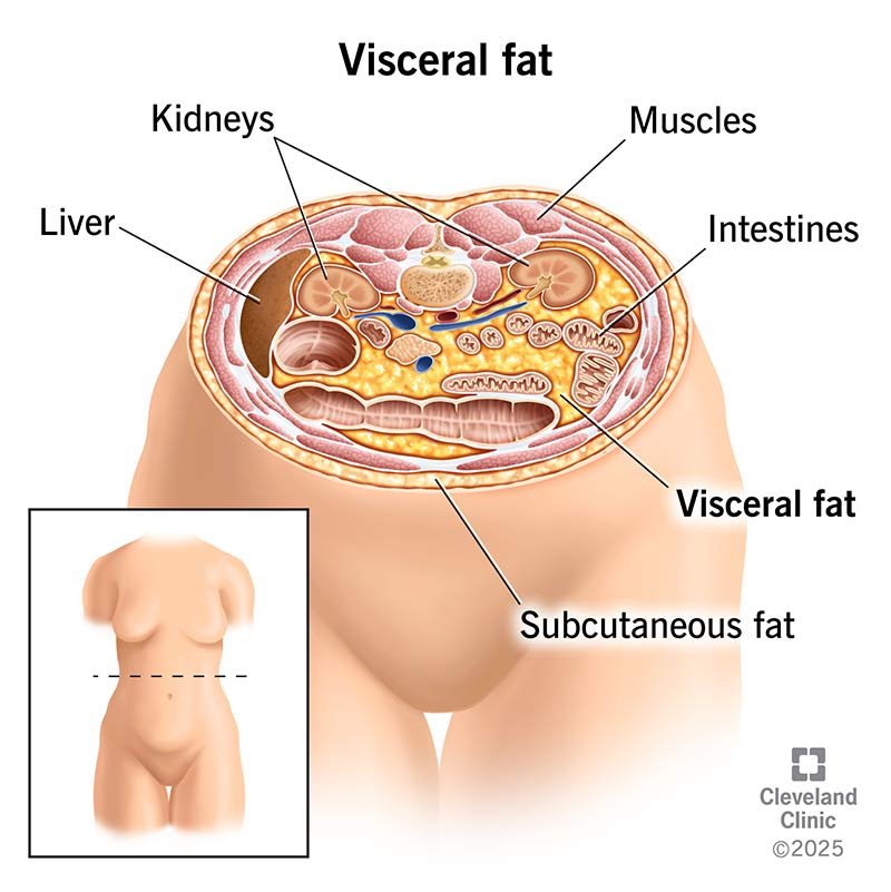 visceral fat diagram to explain dexa scan results