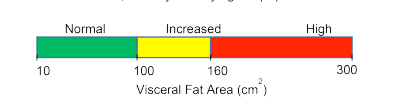 visceral fat thresholds for interpreting DEXA scan
