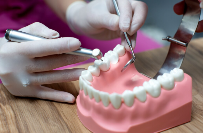 Crowns for Teeth near kent WA