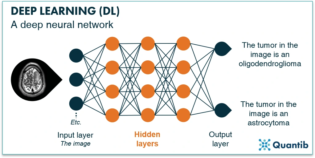 deep-learning-quantib