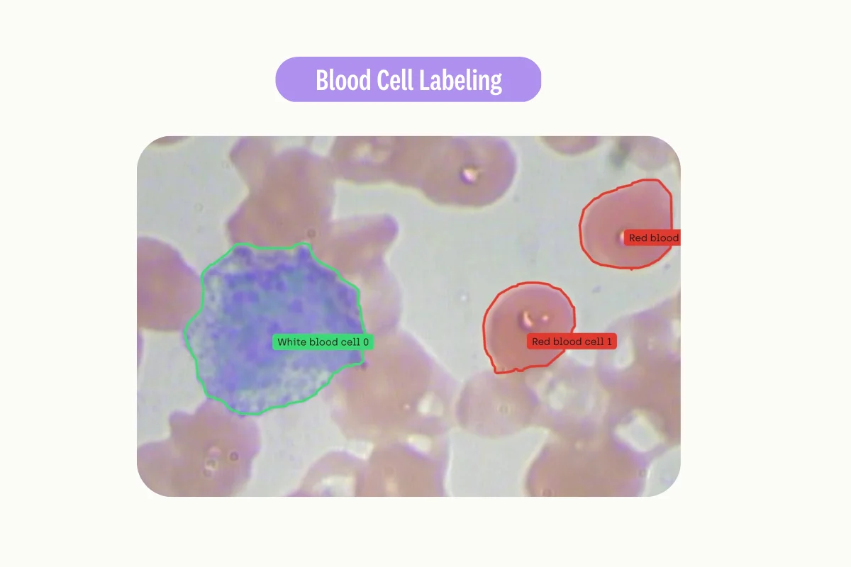 Labeling white blood cell and red blood cell